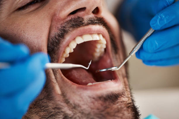 Best Emergency Broken Tooth Repair in Boyne City, MI